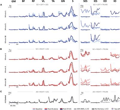 Effects of Multi-Muscle Electrical Stimulation and Stand Training on Stepping for an Individual With SCI